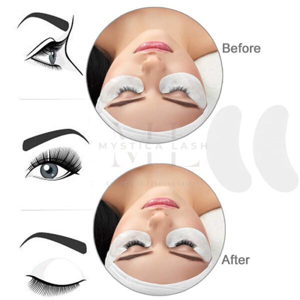 Before And After Eyelash Extensions Using Eye Patches