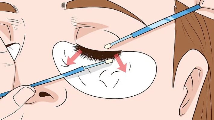 Remove Client Eyelash Extensions